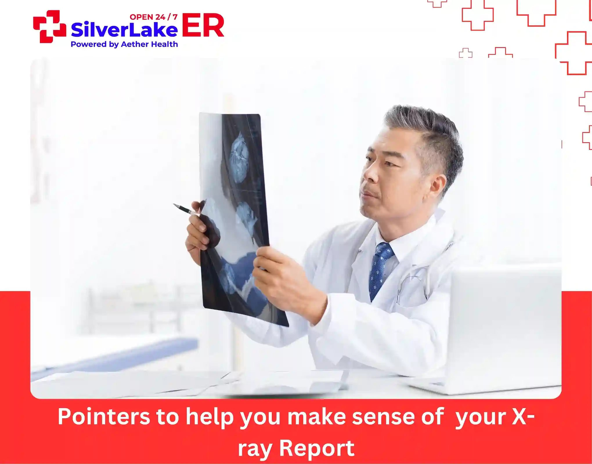 Pointers to help you make sense of your X-ray Report